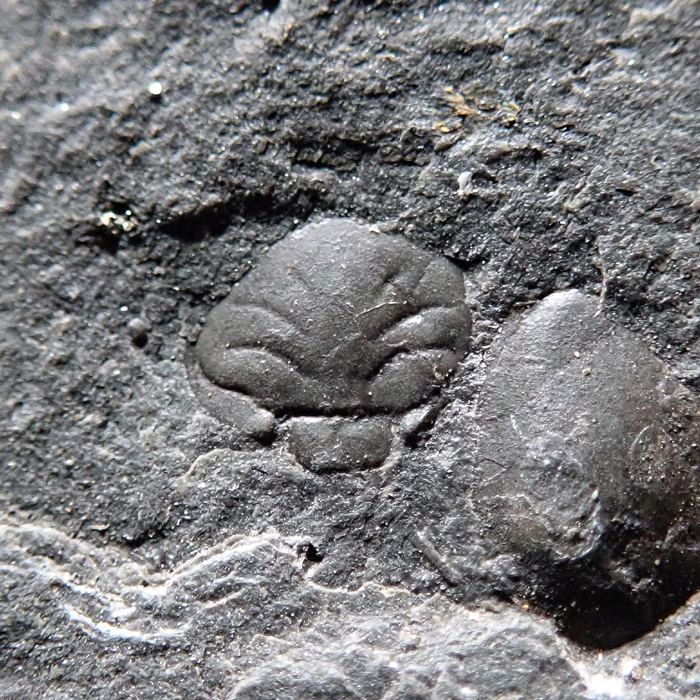 glabela - 5 mm (sag), Levín